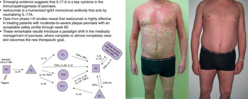 what to know about hizzaboloufazic